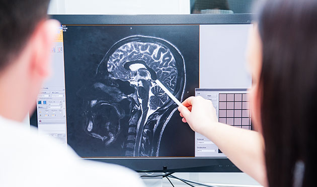 Médecins qui analysent une IRM du cerveau
